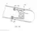 Fig. 24 - Implantable devices and related methods for heart failure monitoring