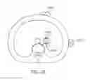Fig. 27 - Implantable devices and related methods for heart failure monitoring