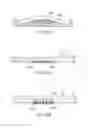 Fig. 33 - Implantable devices and related methods for heart failure monitoring