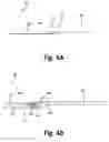 Fig. 05 - FLUID FILLED IMAGING CATHETER