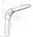 Fig. 01 - Illuminated surgical retractor