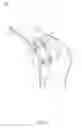 Fig. 08 - Illuminated surgical retractor