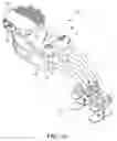 Fig. 02 - Surgical rib retractor