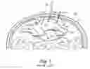 Fig. 02 - Instruments for delivering transfascial sutures and methods of transfascial suturing