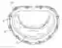 Fig. 01 - Suture fastener having spaced-apart layers