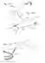 Fig. 14 - Suture fastener having spaced-apart layers