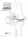 Fig. 02 - Surgical apparatus having a frame and moving support structure and method therefore