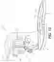 Fig. 07 - Surgical apparatus having a frame and moving support structure and method therefore