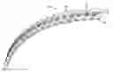 Fig. 01 - Bone plate fastening system
