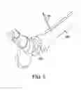 Fig. 08 - Ankle replacement system and method