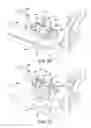 Fig. 22 - Ankle replacement system and method