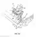 Fig. 41 - Ankle replacement system and method