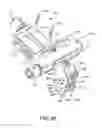Fig. 43 - Ankle replacement system and method