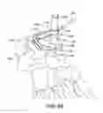 Fig. 65 - Ankle replacement system and method