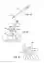 Fig. 71 - Ankle replacement system and method