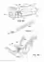Fig. 74 - Ankle replacement system and method