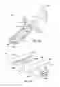Fig. 76 - Ankle replacement system and method