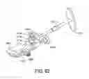 Fig. 77 - Ankle replacement system and method