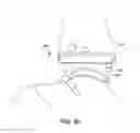 Fig. 83 - Ankle replacement system and method