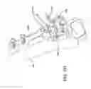 Fig. 85 - Ankle replacement system and method