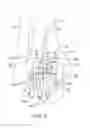 Fig. 06 - Patient-specific surgical devices, systems, and methods