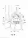 Fig. 07 - Patient-specific surgical devices, systems, and methods