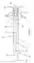 Fig. 02 - Method and catheter for creating an interatrial aperture
