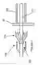 Fig. 06 - Method and catheter for creating an interatrial aperture