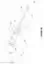 Fig. 14 - Method and catheter for creating an interatrial aperture