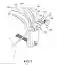 Fig. 05 - Fixation device