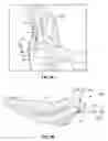 Fig. 04 - Internal pelvic fixator