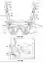 Fig. 16 - Internal pelvic fixator