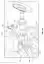 Fig. 20 - Internal pelvic fixator