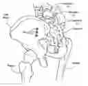 Fig. 01 - Implants for spinal fixation or fusion