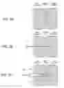 Fig. 03 - Implants for spinal fixation or fusion