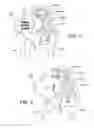 Fig. 07 - Implants for spinal fixation or fusion