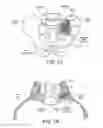 Fig. 08 - Implants for spinal fixation or fusion