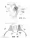 Fig. 13 - Implants for spinal fixation or fusion