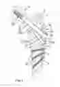 Fig. 02 - Device for fixation of bone fragments