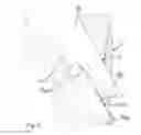 Fig. 04 - Device for fixation of bone fragments