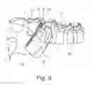 Fig. 06 - Method for implantation of an implant for pelvic ring fractures