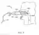 Fig. 09 - Soft palate treatment