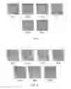 Fig. 07 - Method and apparatus for selective treatment of biological tissue