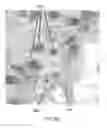 Fig. 10 - Method and apparatus for selective treatment of biological tissue