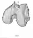 Fig. 04 - SYSTEM AND METHOD FOR OPTIMIZING AN IMPLANT POSITION IN AN ANATOMICAL JOINT