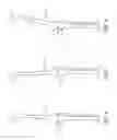 Fig. 04 - System and method for pre-operatively determining desired alignment of a knee joint