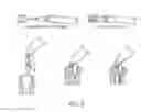 Fig. 09 - Precision injector/extractor for robot-assisted minimally-invasive surgery
