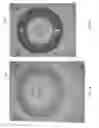 Fig. 13 - Dental system and method