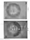 Fig. 17 - Dental system and method