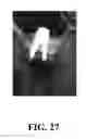 Fig. 28 - System and method for the design, creation and installation of implant-supported dental prostheses